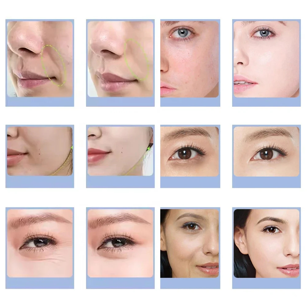 7 Jenis Mesin Gelembung Oksige - Aha Bha Exfoliant ulasan dan harga