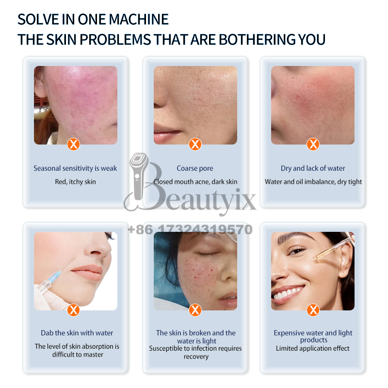 Mesin Perawatan Wajah Hello Fa - Skincare Ls ulasan dan harga