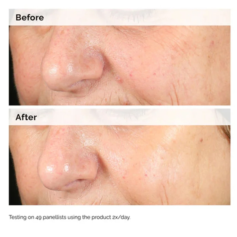 Serum Alpha Arbutin 2% + HA 30 - Aha Bha Exfoliant ulasan dan harga