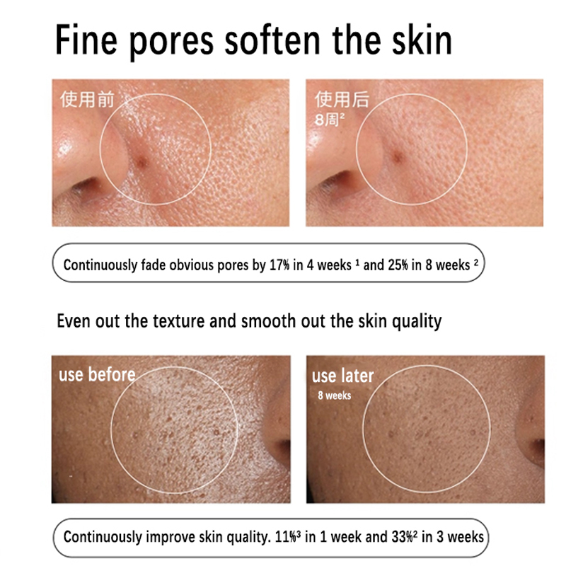 Serum Aloe 2% + NAG 2% 30ml Mu - Aha Bha Exfoliant ulasan dan harga