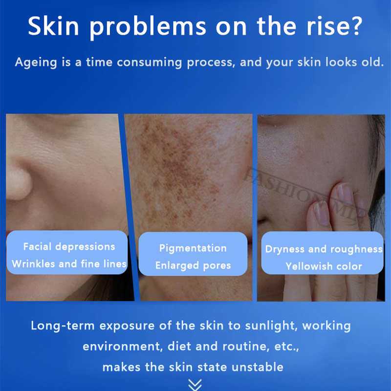 80% spons biru Kit microalga k - Hyaluronic Acid Serum ulasan dan harga