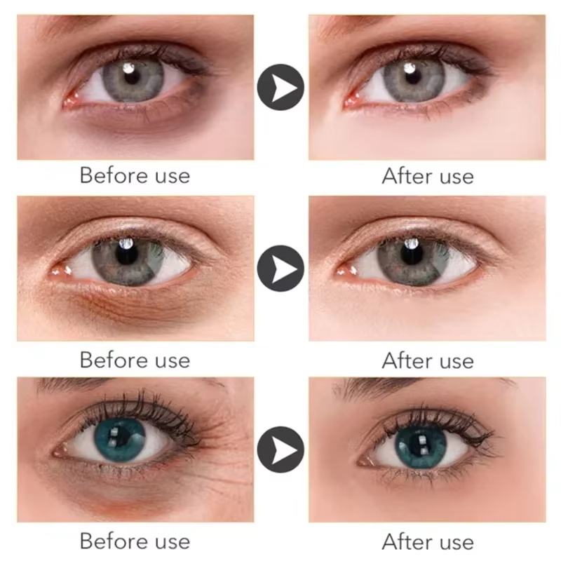 Serum Mata Anti Lingkaran Hita - Hyaluronic Acid Serum ulasan dan harga